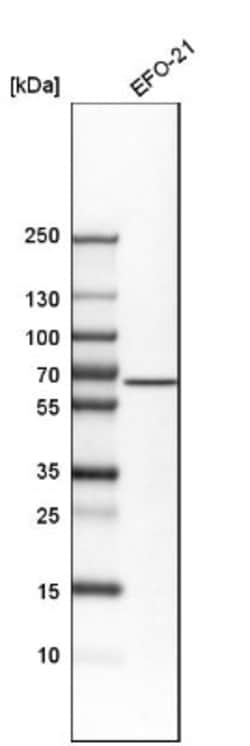 ALK-1 Antibody, Novus Biologicals 0.1mL; Unlabeled:Antibodies, Polyclonal